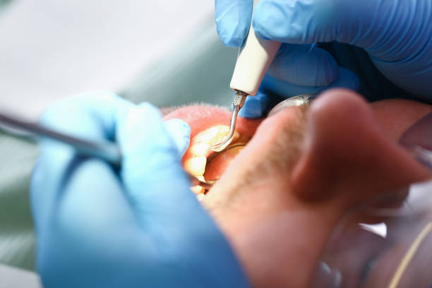 Best Chipped Tooth Repair Near Me  in Rincon Valley, AZ