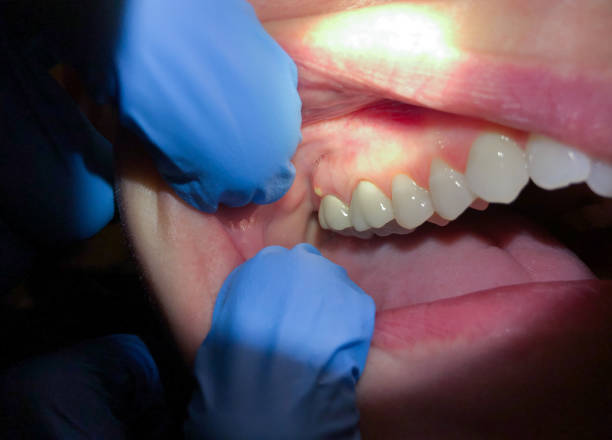 Urgent Tooth Repair in AZ